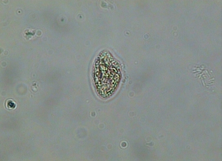 Dictyocha speculum